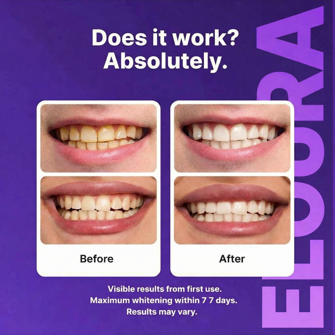 Purple Instant Teeth Whitening Strips