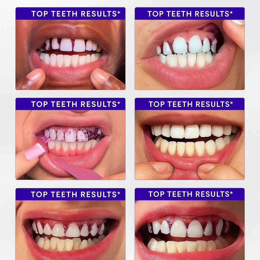 Purple Instant Teeth Whitening Strips