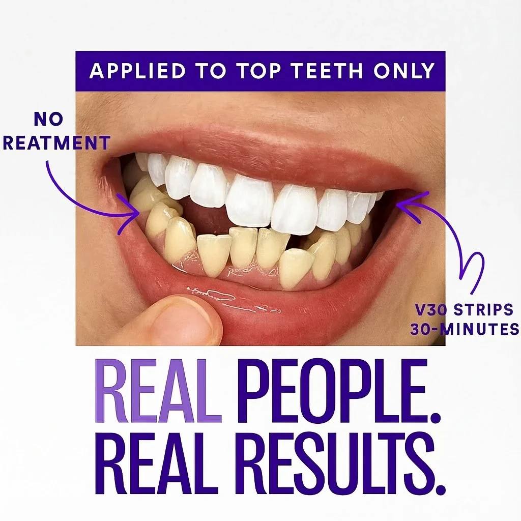 Purple Instant Teeth Whitening Strips