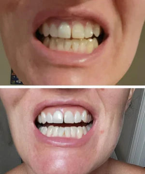 Purple Instant Teeth Whitening Strips